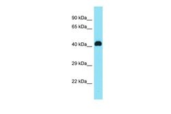 Invitrogen C8orf76 Polyclonal Antibody 100 &mu;L | Buy Online | Invitrogen&trade; | Fisher Scientific