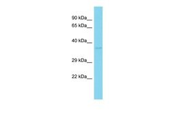 LYSMD3 Polyclonal Antibody:Antibodies, Polyclonal