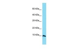Invitrogen C11orf94 Polyclonal Antibody 100 &mu;L | Buy Online | Invitrogen&trade; | Fisher Scientific