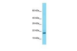 Invitrogen TDRP Polyclonal Antibody 100 &mu;L; Unconjugated:Antibodies,
