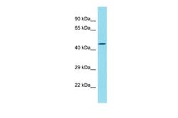 Invitrogen DBF4B Polyclonal Antibody 100 &mu;L; Unconjugated:Antibodies,
