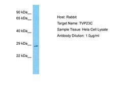 Invitrogen TVP23C Polyclonal Antibody 100 &mu;L; Unconjugated:Antibodies,