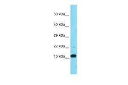 Invitrogen FAM25A Polyclonal Antibody 100 &mu;L; Unconjugated:Antibodies,