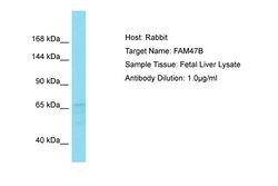 Invitrogen FAM47B Polyclonal Antibody 100 &mu;L; Unconjugated:Antibodies,
