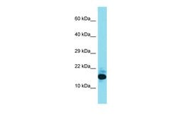 Invitrogen FAM177B Polyclonal Antibody 100 &mu;L; Unconjugated:Antibodies,
