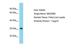 Invitrogen MAGEB5 Polyclonal Antibody 100 &mu;L; Unconjugated:Antibodies,