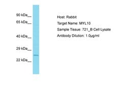 MYL10 Polyclonal Antibody, Invitrogen 100 &mu;L; Unconjugated:Antibodies,