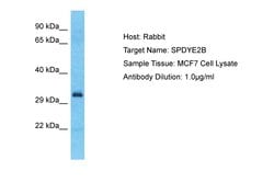 SPDYE2B Polyclonal Antibody, Invitrogen 100 &mu;L; Unconjugated:Antibodies,