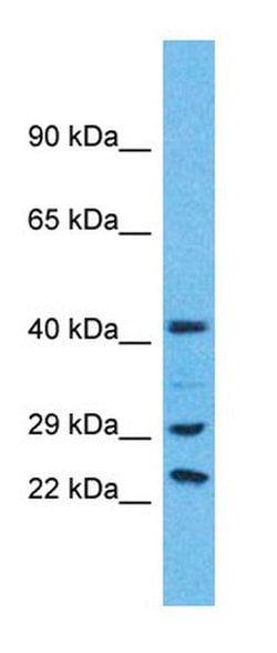 USP41 Polyclonal Antibody:Antibodies, Polyclonal
