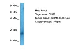 Invitrogen C6orf99 Polyclonal Antibody 100 &mu;L | Buy Online | Invitrogen&trade; | Fisher Scientific