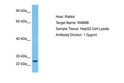 Invitrogen RAB6B Polyclonal Antibody 100 &mu;L; Unconjugated:Antibodies,