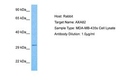 Invitrogen ANXA8L1 Polyclonal Antibody 100 &mu;L; Unconjugated:Antibodies,