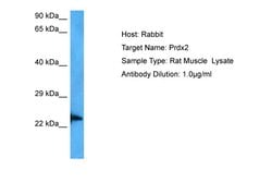 Invitrogen PRDX2 Polyclonal Antibody 100 &mu;L; Unconjugated:Antibodies,