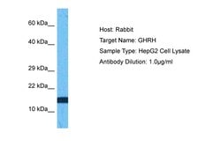 Invitrogen GHRH Polyclonal Antibody 100 &mu;L; Unconjugated:Antibodies,