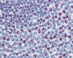 Invitrogen FOXM1 Polyclonal Antibody 100 &mu;L | Buy Online | Invitrogen&trade; | Fisher Scientific