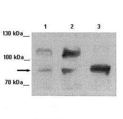 Invitrogen FOXM1 Polyclonal Antibody 100 &mu;L | Buy Online | Invitrogen&trade; | Fisher Scientific