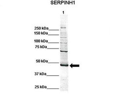 Invitrogen SERPINH1 Polyclonal Antibody 100 &mu;L | Buy Online | Invitrogen&trade; | Fisher Scientific