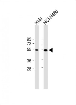 Invitrogen FGL2 Polyclonal Antibody 400 &mu;L; Unconjugated:Antibodies,
