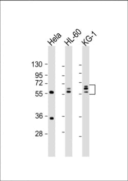 Invitrogen FGL2 Polyclonal Antibody 400 &mu;L; Unconjugated:Antibodies,