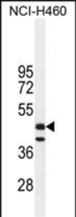 Invitrogen FGL2 Polyclonal Antibody 400 &mu;L; Unconjugated:Antibodies,