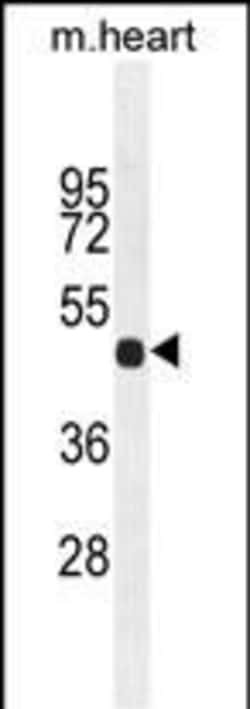 Invitrogen FGL2 Polyclonal Antibody 400 &mu;L; Unconjugated:Antibodies,