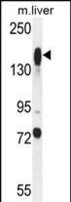 Invitrogen ASXL1 Polyclonal Antibody 400 &mu;L; Unconjugated:Antibodies,