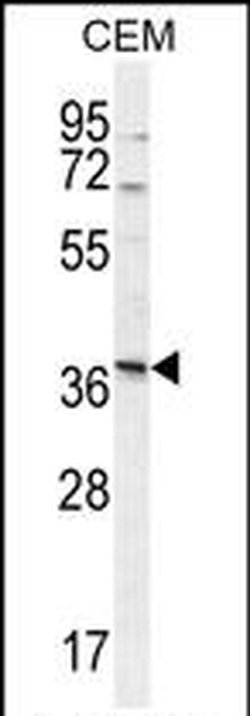 NXPH4 Rabbit anti-Human, Polyclonal, Invitrogen 400 &mu;L; Unconjugated:Antibodies,