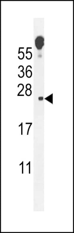 Invitrogen Vopp1 Polyclonal Antibody 400 &mu;L; Unconjugated:Antibodies,