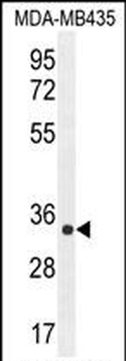 ALKBH6 Rabbit anti-Human, Mouse, Polyclonal, Invitrogen 400 &mu;L; Unconjugated:Antibodies,