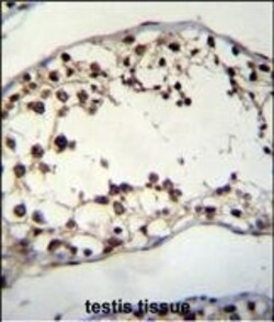 Invitrogen PIH1D2 Polyclonal Antibody 400 &mu;L; Unconjugated:Antibodies,
