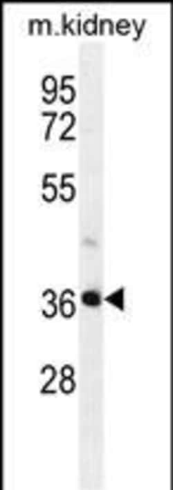Invitrogen PIH1D2 Polyclonal Antibody 400 &mu;L; Unconjugated:Antibodies,