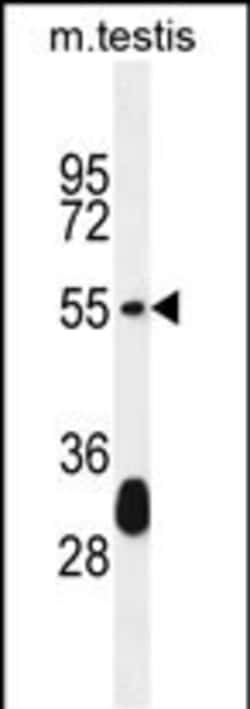 Invitrogen Krt33a Polyclonal Antibody 400 &mu;L; Unconjugated:Antibodies,