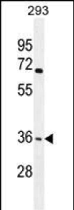 OR4F15 Polyclonal Antibody:Antibodies, Polyclonal