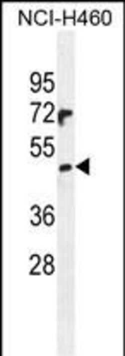 Invitrogen PRAMEF6 Polyclonal Antibody 400 &mu;L; Unconjugated:Antibodies,