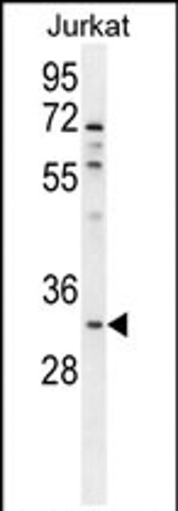 OR5B12 Rabbit anti-Human, Polyclonal, Invitrogen 400 &mu;L; Unconjugated:Antibodies,