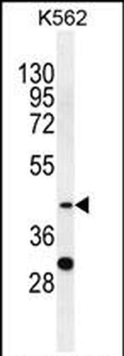 SERPINB4 Rabbit anti-Human, Polyclonal, Invitrogen 400 &mu;L; Unconjugated:Antibodies,
