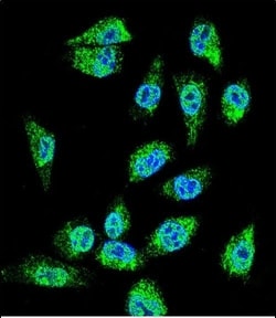 Invitrogen MIC-1 Polyclonal Antibody 400 &mu;L; Unconjugated:Antibodies,