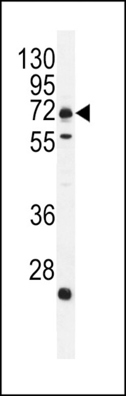 Invitrogen MIC-1 Polyclonal Antibody 400 &mu;L; Unconjugated:Antibodies,