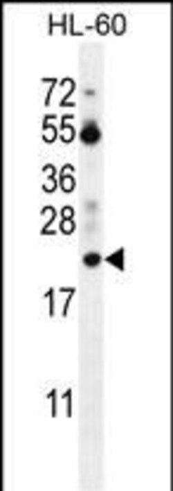 Invitrogen PTMA Polyclonal Antibody 400 &mu;L; Unconjugated:Anticorps,