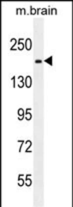 Invitrogen FIP200 Polyclonal Antibody 400 &mu;L; Unconjugated:Antibodies,