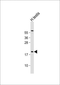 Invitrogen CT45A Polyclonal Antibody 400 &mu;L; Unconjugated:Antibodies,