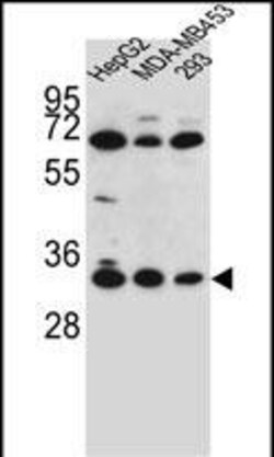 Invitrogen OR2T3 Polyclonal Antibody 400 &mu;L; Unconjugated:Antibodies,