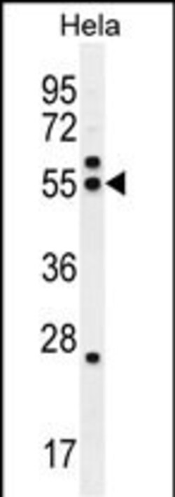 Invitrogen TUBB8P12 Polyclonal Antibody 400 &mu;L | Buy Online | Invitrogen&trade; | Fisher Scientific