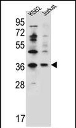 PPP1R3G Rabbit anti-Human, Polyclonal, Invitrogen 400 &mu;L; Unconjugated:Antibodies,