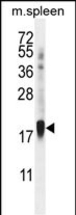 Invitrogen ZNF593 Polyclonal Antibody 400 &mu;L; Unconjugated:Antibodies,