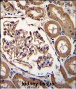 Invitrogen CD249 Polyclonal Antibody 400 &mu;L; Unconjugated:Antibodies,