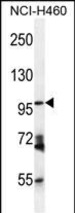 Invitrogen CD249 Polyclonal Antibody 400 &mu;L; Unconjugated:Antibodies,