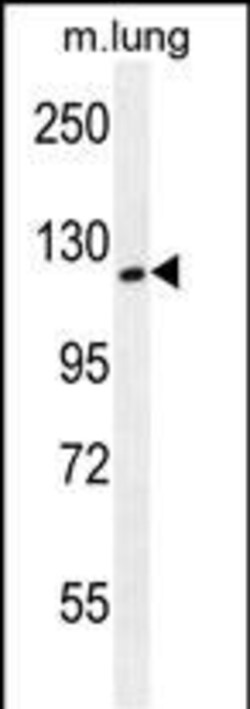 Invitrogen SPECC1L Polyclonal Antibody 400 &mu;L | Buy Online | Invitrogen&trade; | Fisher Scientific