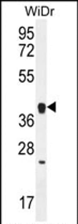 OR2T8 Polyclonal Antibody, Invitrogen 400 &mu;L; Unconjugated:Antibodies,