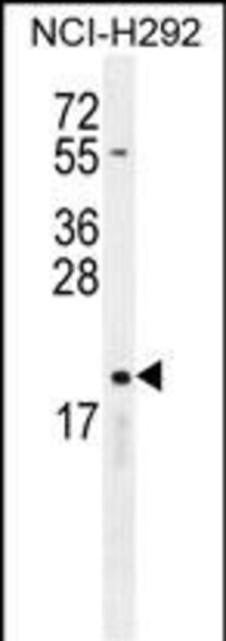 Invitrogen CYBA Polyclonal Antibody 400 &mu;L; Unconjugated:Antibodies,